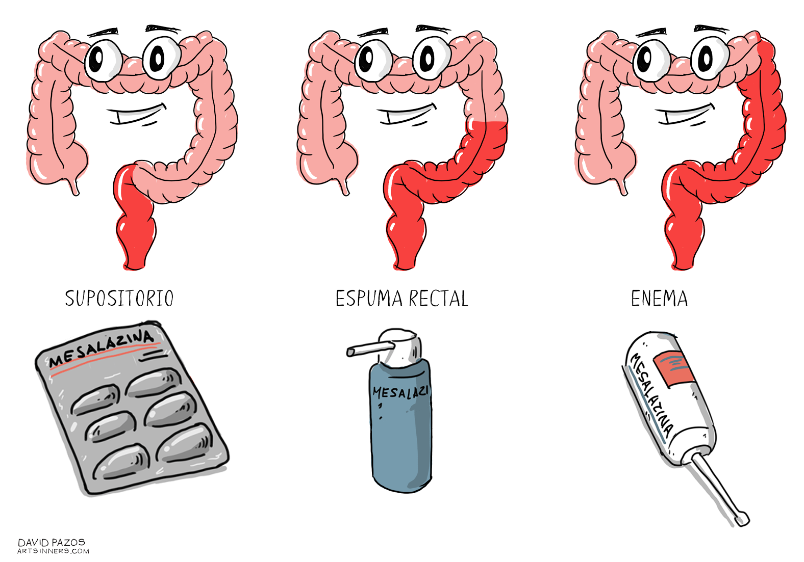 Educainflamatoria Enfermedad Inflamatoria Intestinal Crohn Y